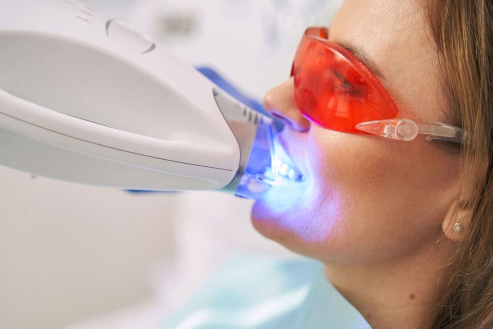 Dentallaser in der Zahnmedizin